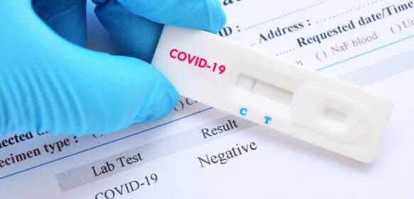CMD arremete contra el Gobierno ante invalidez de pruebas Covid realizadas en casa