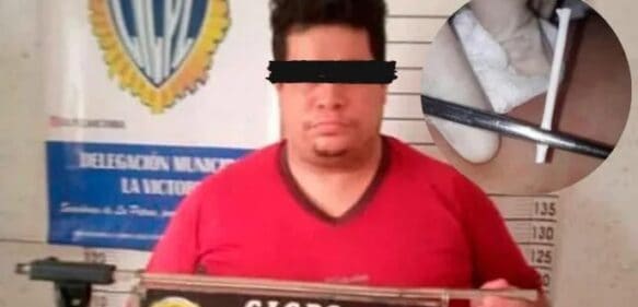 Arrestan falso ginecólogo que colocaba palitos de bolones a sus víctimas como método anticonceptivo