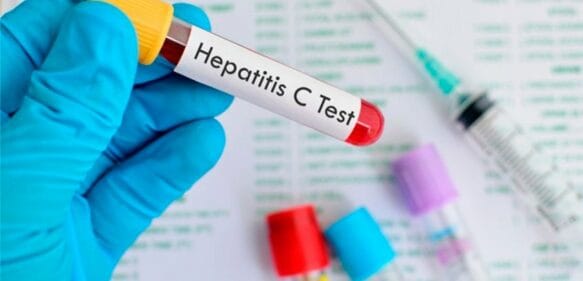 Ascienden a 300 casos de hepatitis aguda de origen desconocido en niños en el mundo