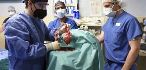 Encuentran virus en corazón de cerdo trasplantado a hombre