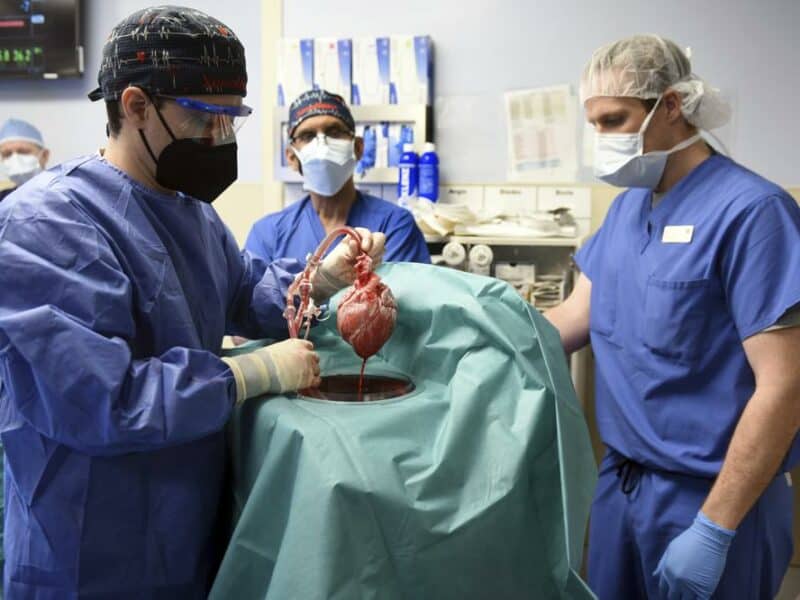Encuentran virus en corazón de cerdo trasplantado a hombre