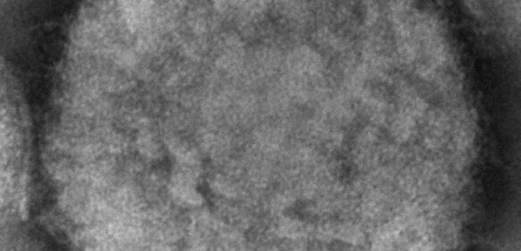 EEUU reporta primer caso de viruela símica en Massachusetts