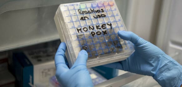 Un hombre infectado de viruela del mono huye de un hospital de Jalisco y vuela a EE.UU.
