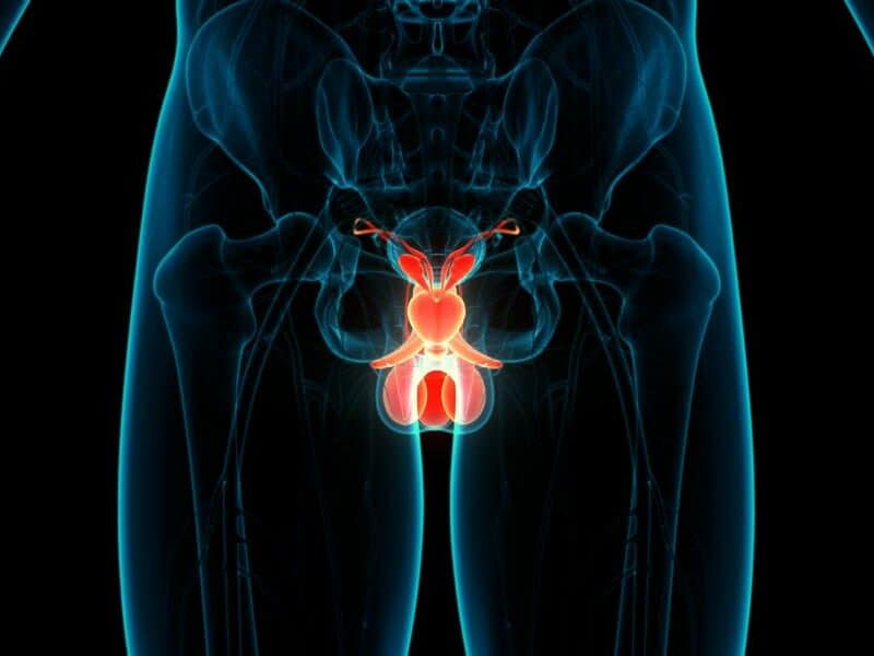 Alrededor del 50% de pacientes con cáncer de próstata nunca han ido a una evaluación por un urólogo, según estudios
