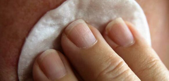 Especialistas del Moscoso Puello recomiendan cuidar la piel