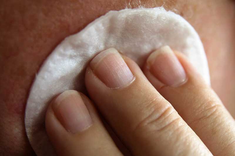Especialistas del Moscoso Puello recomiendan cuidar la piel