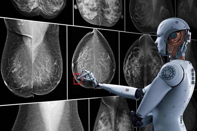 Así funciona la inteligencia artificial que es capaz de detectar más rápido el cáncer de mama