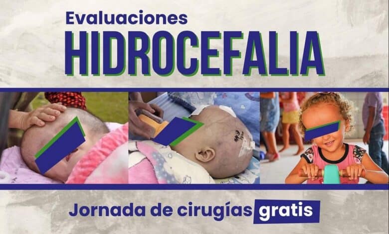 Fundación Cruz Jiminían junto al hospital el Buen Samaritano anuncian jornada de cirugías para pacientes con hidrocefalia totalmente gratis