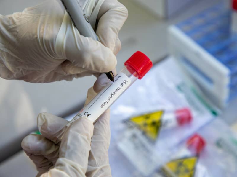 Decenas de personas acuden a Salud Pública para realizarse pruebas PCR