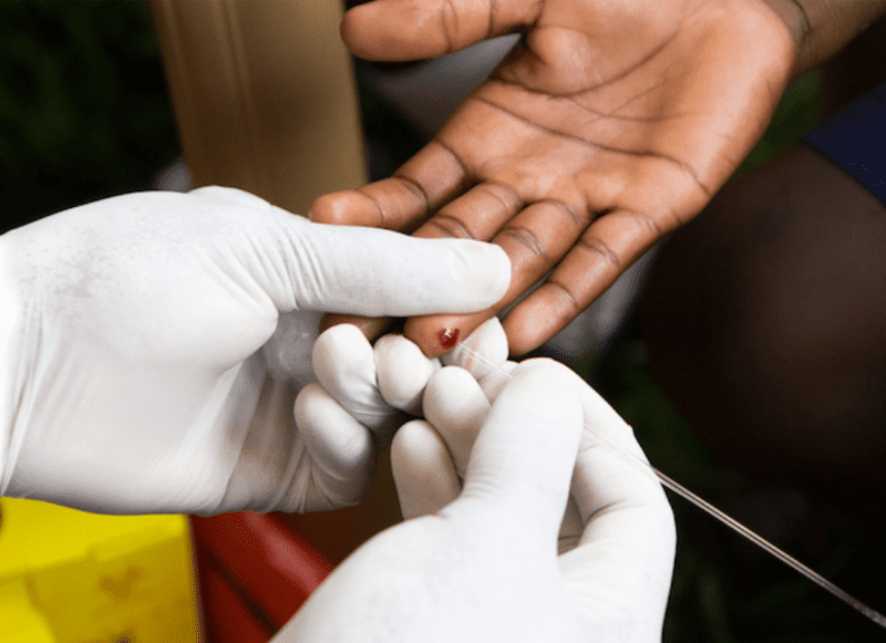 Semana Mundial del Tamizaje de VIH: Hazte la prueba. En RD hay 72,000 personas con VIH