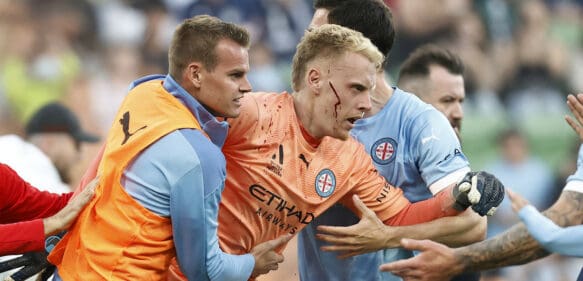 Hinchas invaden la cancha y hieren a un jugador durante un derbi del fútbol australiano