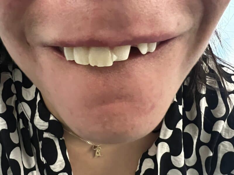 Mujer denuncia sufre lesiones y pierde diente al ser golpeada por ex pareja sentimental