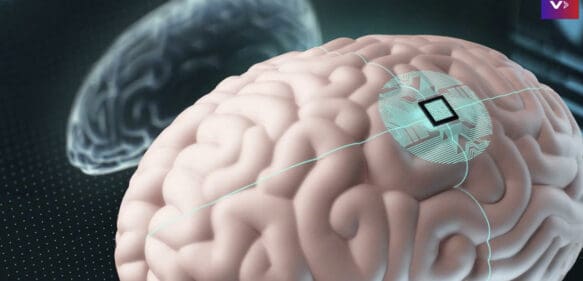 Implante cerebral podría restaurar la función en extremidades paralizadas