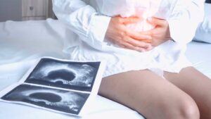 Cómo prevenir el cáncer de cuello uterino y cuál es su vínculo con el virus del papiloma humano