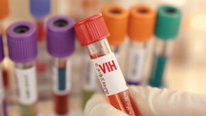 El estigma y el VIH: cómo la desinformación contribuye a la propagación de mitos