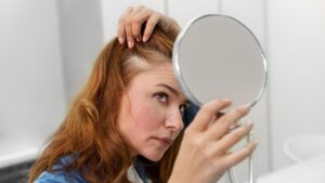 Alerta capilar: estos signos revelan que tu cuero cabelludo no está bien