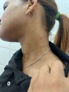 Padre pide agilizar pedimento de medida de coerción contra agresor de su hija