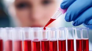 Día Mundial del Cáncer de Sangre: nuevo avance en el tratamiento de la leucemia mieloide crónica