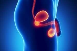 Aseguran el cáncer de próstata no solo es una enfermedad de hombres mayores