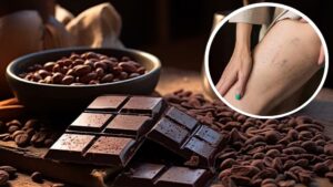 Sentir las piernas pesadas al final del día, notar hinchazón o pequeñas venas visibles en la piel son molestias frecuentes que muchas personas, especialmente mujeres, experimentan con regularidad. Aunque a menudo se minimizan, estos síntomas pueden ser señales de problemas circulatorios, como las várices. 4 malos hábitos a evitar después de las 5pm para reducir el riesgo de accidente cerebrovascular Te puede interesar: 4 malos hábitos a evitar después de las 5pm para reducir el riesgo de accidente cerebrovascular En este contexto, la ciencia ha comenzado a explorar alternativas accesibles desde la alimentación cotidiana. Uno de los alimentos que ha cobrado interés es el cacao, señalado por diversos estudios como un posible aliado en la mejora de la salud venosa. Propiedades del cacao y respaldo científico El cacao no solo es apreciado por su sabor, sino también por su composición nutricional. Contiene minerales esenciales como hierro, magnesio, manganeso y fibra, además de una mezcla equilibrada de grasas saludables. También aporta teobromina y cafeína, dos compuestos con efectos estimulantes suaves. El cereal que proporciona más energía que la quinoa y el arroz integral Te puede interesar: El cereal que proporciona más energía que la quinoa y el arroz integral Lo más relevante es su alta concentración de polifenoles y flavonoles, sustancias antioxidantes que han sido ampliamente estudiadas por sus efectos en la salud cardiovascular. Estudios publicados en las revistas Nutrients, Archives of Internal Medicine, JAMA y The Journal of Nutrition indican que el cacao puede favorecer la función endotelial, mejorar la elasticidad de los vasos sanguíneos y reducir la inflamación sistémica. Una investigación publicada en The Una investigación publicada en The Journals of Gerontology destaca que el cacao mejora fuerza muscular y reduce inflamación en mayores de 50 años (freepik) Un estudio citado en la revista The Journals of Gerontology: Series A concluyó que el consumo diario de una cucharada de cacao mejora la fuerza muscular y la capacidad funcional en personas mayores de 50 años, además de reducir indicadores inflamatorios. Estos resultados refuerzan la idea de que su consumo moderado podría ser útil en el manejo de afecciones circulatorias como las várices. Estrés y ansiedad: cómo diferenciarlos y afrontarlos eficazmente Te puede interesar: Estrés y ansiedad: cómo diferenciarlos y afrontarlos eficazmente Asimismo, el cacao ofrece ventajas frente a otros productos derivados del chocolate, ya que contiene menos azúcares añadidos y conserva una mayor cantidad de antioxidantes. “El cacao puro contiene más antioxidantes y menos azúcar añadido, lo que lo convierte en una opción más saludable. Y, en este caso, es perfecto para tratar las várices”, afirma Women’s Health. Cacao puro y salud vascular Las investigaciones recientes han puesto el foco en el cacao por su capacidad antioxidante y su potencial para aliviar los síntomas de la insuficiencia venosa crónica. Esta condición, que afecta a millones de personas, se caracteriza por un mal funcionamiento del sistema venoso, lo que impide el retorno eficiente de la sangre al corazón. Las várices, una manifestación común de esta afección, suelen presentarse como venas dilatadas y dolorosas en las piernas. Estudios destacan el cacao puro Estudios destacan el cacao puro como una solución prometedora para aliviar los síntomas de la insuficiencia venosa crónica (Imagen Ilustrativa Infobae) La evidencia recogida por Women’s Health se apoya en estudios publicados en revistas científicas como Nutrients, JAMA y The Journal of Nutrition, que relacionan el consumo de cacao con mejoras en la circulación sanguínea, reducción de la presión arterial y disminución de marcadores inflamatorios. Estas investigaciones sugieren que pequeños cambios en la dieta, como la inclusión de cacao puro, pueden contribuir al bienestar circulatorio. Causas y síntomas de las várices La insuficiencia venosa crónica afecta en mayor proporción a las mujeres, aunque también puede presentarse en hombres. Expertos consultados por Women’s Health explicaron que las causas pueden ser tanto genéticas como vinculadas al estilo de vida. Entre los principales factores de riesgo se encuentran los antecedentes familiares, el sedentarismo, el sobrepeso y la permanencia prolongada en una misma posición, ya sea de pie o sentado. Los síntomas principales de esta Los síntomas principales de esta enfermedad incluyen pesadez, calambres, hinchazón y dolor en las piernas ( VisualesIA) Los síntomas más frecuentes incluyen sensación de pesadez, calambres, edemas y dolor en las piernas. Ante la aparición de estos signos, se recomienda consultar a un especialista en medicina vascular, quien podrá indicar el tratamiento más adecuado, que puede ir desde el uso de fármacos hasta procedimientos quirúrgicos. Formas de consumo y recomendaciones A pesar de sus beneficios, el cacao es un alimento calórico, por lo que su ingesta debe realizarse con moderación. Los especialistas citados por Women’s Health aconsejan optar por cacao o chocolates con una concentración igual o superior al 80%, ya que estos productos conservan los compuestos bioactivos sin añadir grandes cantidades de azúcar. Una cucharada diaria puede ser suficiente para obtener sus beneficios sin afectar el balance energético de la dieta. Este consumo debe formar parte de un enfoque integral que incluya actividad física, alimentación equilibrada y seguimiento médico en los casos que lo requieran. Incorporar cacao puro a una Incorporar cacao puro a una dieta equilibrada y ejercicio puede mejorar la circulación y aliviar síntomas de varices (Imagen Ilustrativa Infobae) Según Women’s Health, integrar el cacao puro como parte de un estilo de vida saludable podría representar una estrategia complementaria para mejorar la circulación sanguínea y aliviar los síntomas asociados a las varices. Su respaldo científico lo posiciona como una herramienta accesible que, consumida con responsabilidad, puede contribuir al cuidado del sistema vascular.