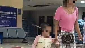 Salvan a una niña de 3 años con un cuchillo clavado en la cabeza