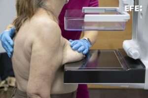 Descubren tratamiento que mejora resultados frente al cáncer de mama avanzado