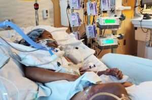 Niño de 7 años pierde ambas piernas tras complicaciones de una gripe